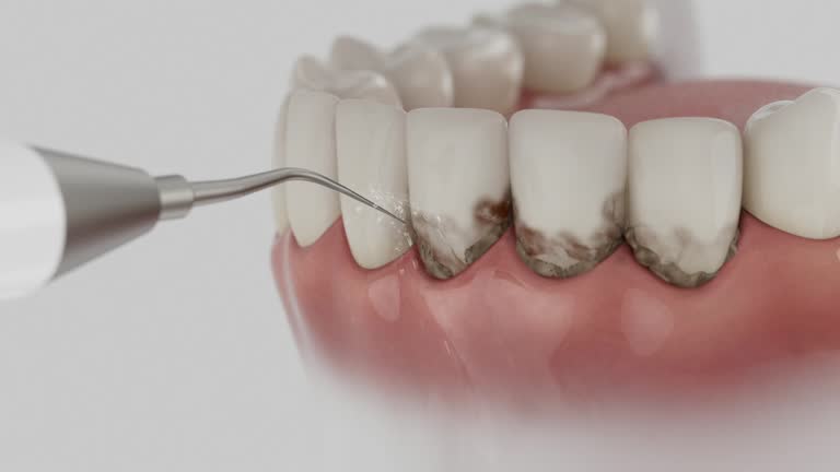 Reliable Dental contractor in Ozark, MO by Smile Center Dentistry